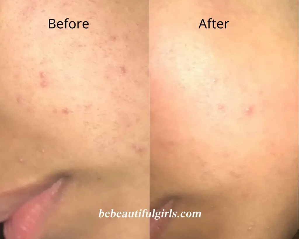 CeraVe Foaming Facial Cleanser Before and After