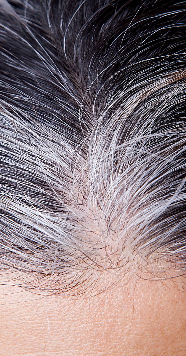 What Causes White Hair At Early Age And How To Prevent It » Bebeautifulgirls