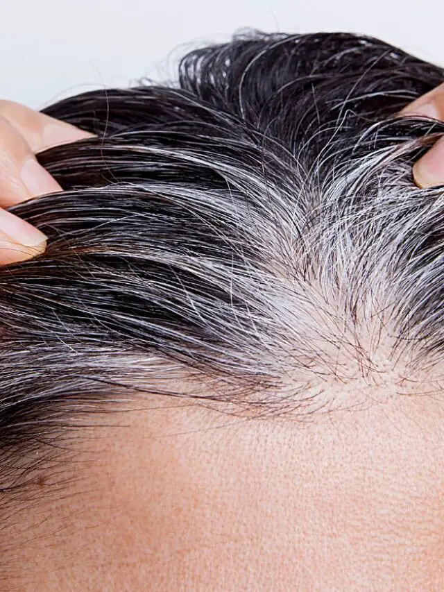 What Causes White Hair at Early Age and How to Prevent It