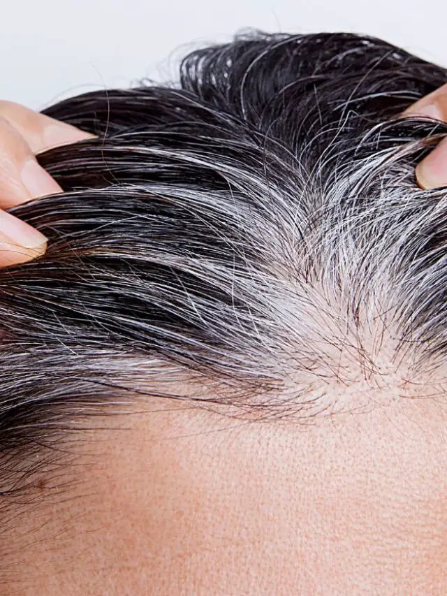 Causes White Hair at Early Age
